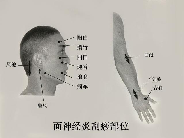 中国西安医疗团队赴哈萨克斯坦培训“洋中医”(图1)